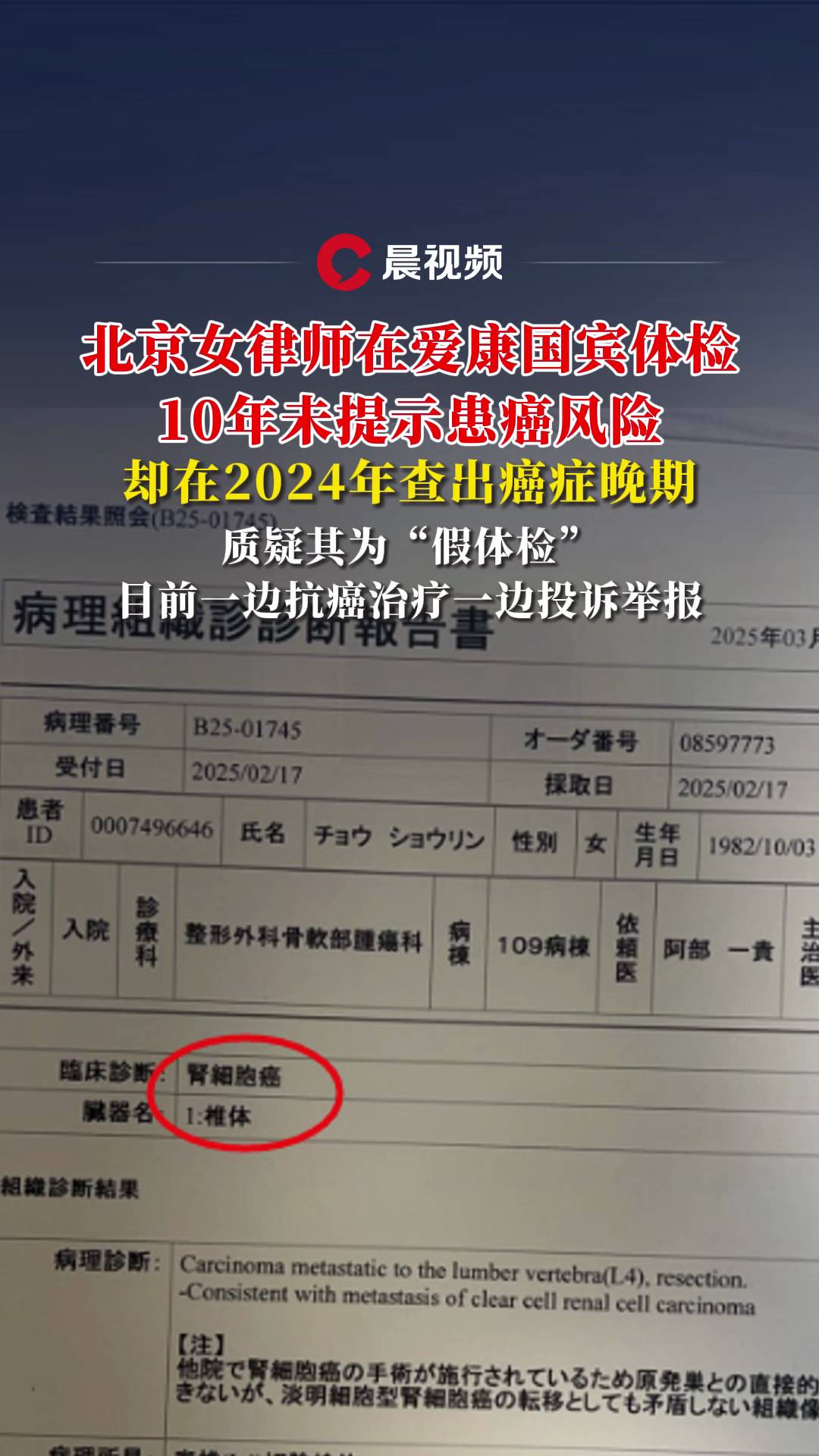 t泿(bo)ŮɎڐ(i)(gu)ewzδʾL(fng)U(xin)sY|(zh)wz
